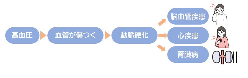 動脈硬化に