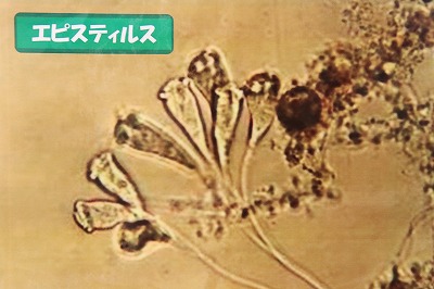 エピスティルス