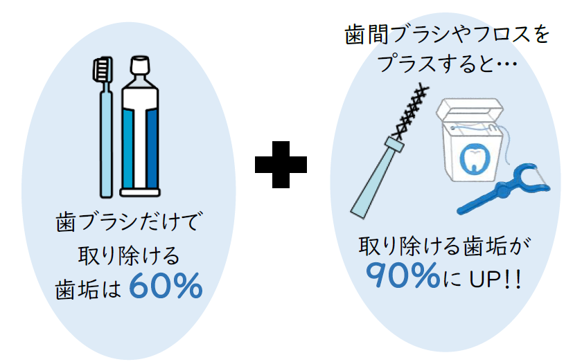 歯ブラシだけで取り除ける歯垢は60%、歯間清掃用具を使うと90%にUP。