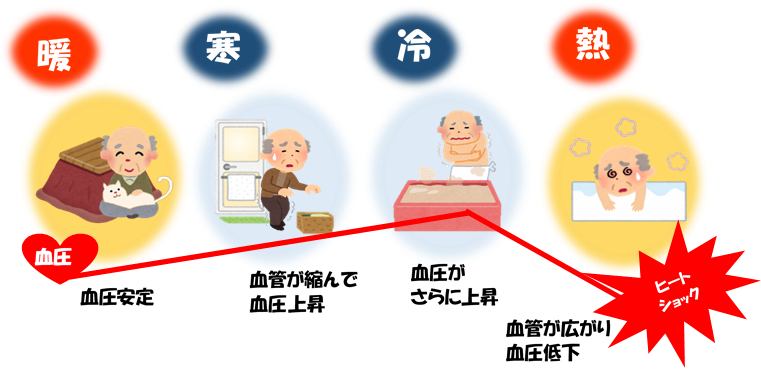 血圧の急激な乱高下図